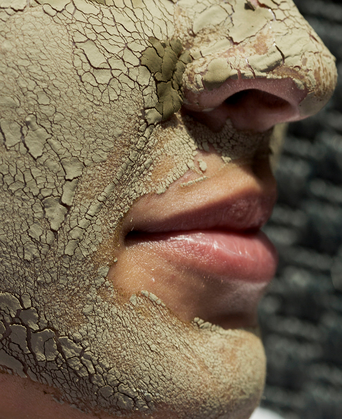 טיפוח טבעי לעור אקנתי ושומני – למצוא את האיזון מבפנים ומבחוץ